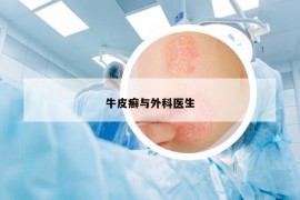 牛皮癣与外科医生