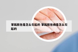 掌跖脓包是怎么引起的 掌跖脓包病是怎么引起的