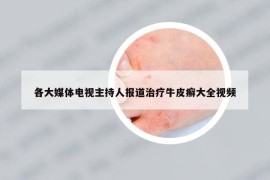 各大媒体电视主持人报道治疗牛皮癣大全视频