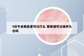 9价牛皮癣患者可以打么 银屑病可以接种九价吗