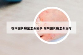 嘴周围长癣是怎么回事 嘴周围长癣怎么治疗