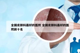 全国皮肤科最好的医院 全国皮肤科最好的医院前十名