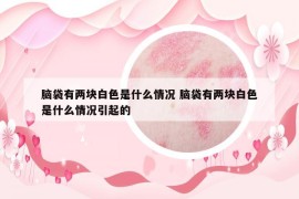 脑袋有两块白色是什么情况 脑袋有两块白色是什么情况引起的