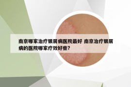 南京哪家治疗银屑病医院最好 南京治疗银屑病的医院哪家疗效好些?