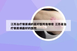 江苏治疗银屑病的最好医院有哪些 江苏省治疗银屑病最好的医院