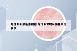 吃什么补黑色素细胞 吃什么食物补黑色素比较快