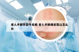 老人手脚开裂牛皮癣 老人手脚爆皮裂口怎么办