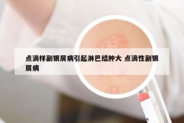 点滴样副银屑病引起淋巴结肿大 点滴性副银屑病