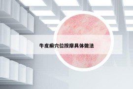 牛皮癣穴位按摩具体做法