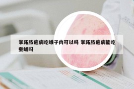 掌跖脓疱病吃蛾子肉可以吗 掌跖脓疱病能吃蚕蛹吗