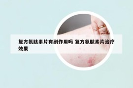 复方氨肽素片有副作用吗 复方氨肽素片治疗效果