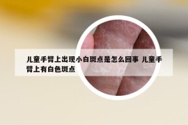 儿童手臂上出现小白斑点是怎么回事 儿童手臂上有白色斑点