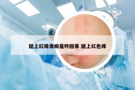 腿上红痒像癣是咋回事 腿上红色痒