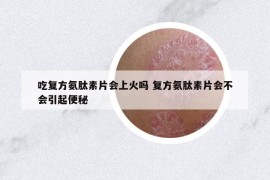 吃复方氨肽素片会上火吗 复方氨肽素片会不会引起便秘