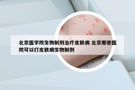 北京医学院生物制剂治疗皮肤病 北京那些医院可以打皮肤病生物制剂