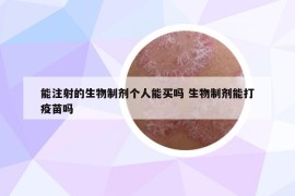 能注射的生物制剂个人能买吗 生物制剂能打疫苗吗