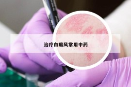 治疗白癜风常用中药