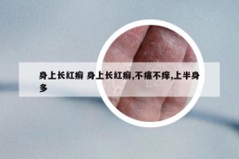 身上长红癣 身上长红癣,不痛不痒,上半身多