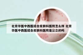 北京华医中西医结合皮肤科医院怎么样 北京华医中西医结合皮肤科医院是公立的吗