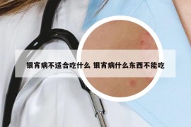 银宵病不适合吃什么 银宵病什么东西不能吃