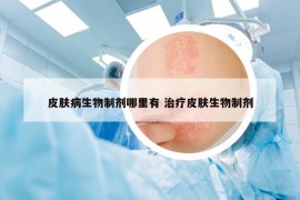 皮肤病生物制剂哪里有 治疗皮肤生物制剂