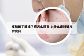 皮肤破了就成了癣怎么回事 为什么皮肤破皮会变藓