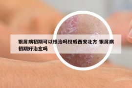 银屑病初期可以根治吗权威西安北方 银屑病初期好治愈吗