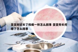 蛋蛋附近长了和癣一样怎么回事 蛋蛋旁长疙瘩了怎么回事