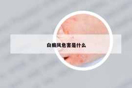 白癜风危害是什么