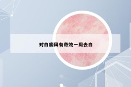 对白癜风有奇效一周去白