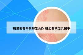 桃里面有牛皮癣怎么办 桃上有锈怎么回事