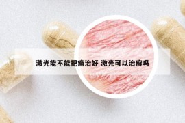 激光能不能把癣治好 激光可以治癣吗