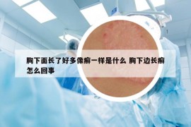 胸下面长了好多像癣一样是什么 胸下边长癣怎么回事