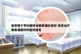 南京哪个专科医院治银屑病比较好 南京治疗银屑病最好的医院排名