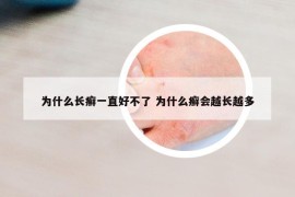 为什么长癣一直好不了 为什么癣会越长越多