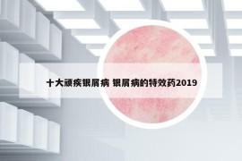 十大顽疾银屑病 银屑病的特效药2019