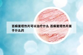 百癣夏塔热片可以治疗什么 百癣夏塔热片属于什么药