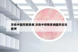 济南中医院银屑病 济南中研银屑病医院主任医师