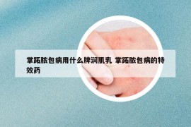 掌跖脓包病用什么牌润肌乳 掌跖脓包病的特效药