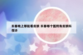 长春晚上那能看皮肤 长春哪个医院有皮肤科夜诊