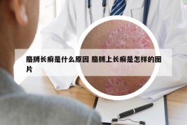 胳膊长癣是什么原因 胳膊上长癣是怎样的图片