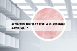 点滴状银屑病好转6大征兆 点滴状银屑病什么样算治好了