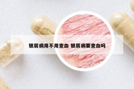 银屑病用不用查血 银屑病要查血吗