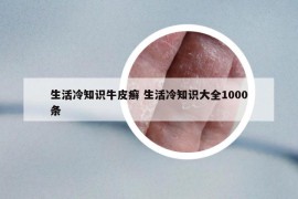 生活冷知识牛皮癣 生活冷知识大全1000条