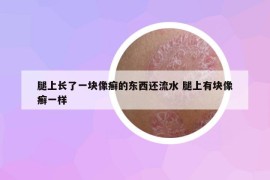 腿上长了一块像癣的东西还流水 腿上有块像癣一样