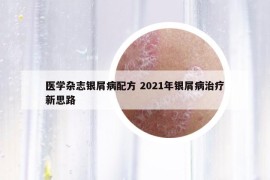 医学杂志银屑病配方 2021年银屑病治疗新思路