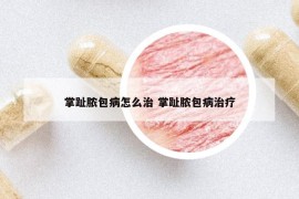 掌趾脓包病怎么治 掌趾脓包病治疗