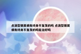 点滴型银屑病有终身不复发的吗 点滴型银屑病有终身不复发的吗能治好吗