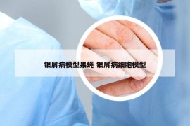 银屑病模型果蝇 银屑病细胞模型