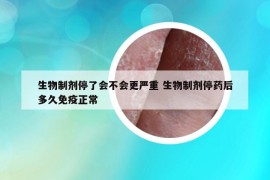 生物制剂停了会不会更严重 生物制剂停药后多久免疫正常